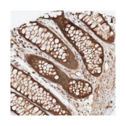 KLHL6, Rabbit, Polyclonal Antibody, Abnova 100&mu;L; Unlabeled:Antibodies,