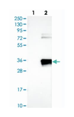 APIP Rabbit anti-Human, Polyclonal Antibody, Abnova 100&mu;L; Unlabeled:Antibodies,