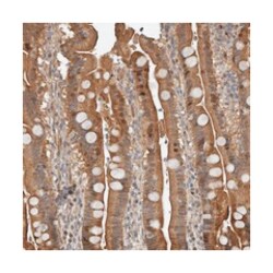 YOD1 Rabbit anti-Human, Polyclonal Antibody, Abnova 100 &mu;L | Buy Online | Abnova Corporation | Fisher Scientific