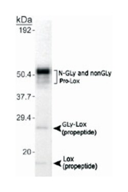 Lox Rabbit anti-Human, Mouse, Pig, Primates, Rat, Polyclonal Antibody,