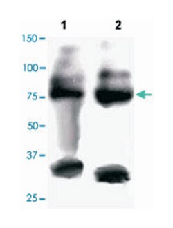 FOXP2, Rabbit, Polyclonal Antibody, Abnova 100&mu;g; Unlabeled:Antibodies,