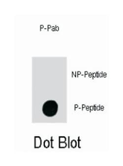 ILK (phospho T173), Rabbit anti-Human, Polyclonal Antibody, Abnova 400&mu;L;