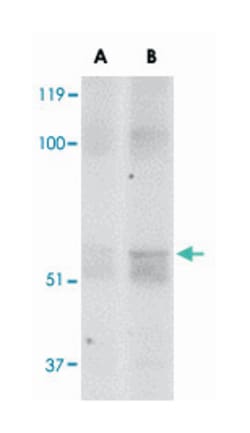 FTO, Rabbit, Polyclonal Antibody, Abnova 100&mu;g; Unlabeled:Anticuerpos