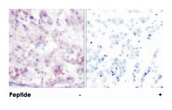 MYB Rabbit anti-Human, Mouse, Polyclonal Antibody, Abnova 100&mu;g; Unlabeled:Antibodies,