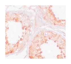 YBX2 Rabbit anti-Human, Mouse, Rat, Polyclonal Antibody, Abnova 100 &mu;g | Buy Online | Abnova Corporation | Fisher Scientific