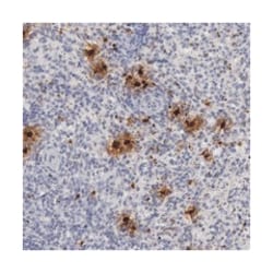 UTY, Rabbit, Polyclonal Antibody, Abnova 100&mu;L; Unlabeled:Antibodies,