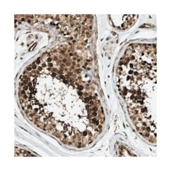 CCDC104 Rabbit anti-Human, Polyclonal Antibody, Abnova 100 &mu;L | Buy Online | Abnova | Fisher Scientific