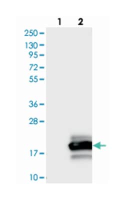 OTOR, Rabbit, Polyclonal Antibody, Abnova 100 &mu;L | Buy Online | Abnova | Fisher Scientific