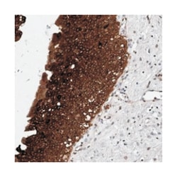 RP9, Rabbit, Polyclonal Antibody, Abnova 100 &mu;L | Buy Online | Abnova Corporation | Fisher Scientific