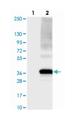C2orf18, Rabbit, Polyclonal Antibody, Abnova 100 &mu;L | Buy Online | Abnova Corporation | Fisher Scientific