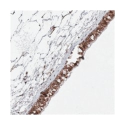 SLC9B1, Rabbit, Polyclonal Antibody, Abnova 100 &mu;L | Buy Online | Abnova Corporation | Fisher Scientific