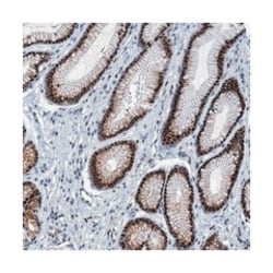 ANKRD13D, Rabbit, Polyclonal Antibody, Abnova 100 &mu;L | Buy Online | Abnova Corporation | Fisher Scientific