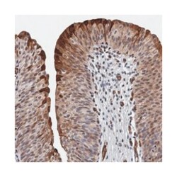 GDPD3 Rabbit anti-Human, Polyclonal Antibody, Abnova 100 &mu;L | Buy Online | Abnova Corporation | Fisher Scientific
