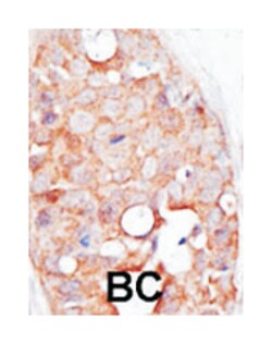 SENP2 Rabbit anti-Human, Polyclonal Antibody, Abnova 400&mu;L; Unlabeled:Antibodies,