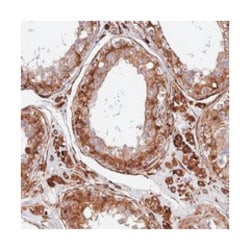 C2orf56, Rabbit, Polyclonal Antibody, Abnova 100 &mu;L | Buy Online | Abnova Corporation | Fisher Scientific