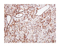 CLU, Mouse, Clone: 1A11, Abnova 100&mu;L; Unlabeled:Antibodies, Monoclonal