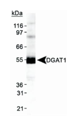 DGAT1, Rabbit, Polyclonal Antibody, Abnova 100&mu;L; Unlabeled:Antibodies,