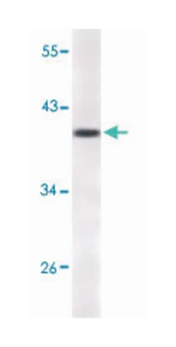 CDKN2A, Mouse, Clone: 5A8A4, 3G8D12, Abnova 100&mu;L; Unlabeled:Antibodies,