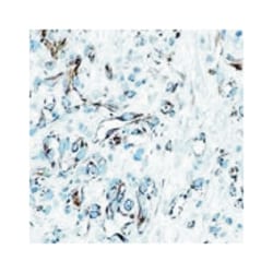 EDNRA, Mouse, Clone: RJT24, Abnova 3 x 1 mL | Buy Online | Abnova Corporation | Fisher Scientific