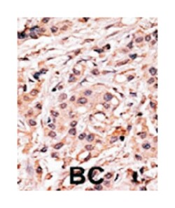 Abnova Corporation TP53 (phospho S20), Rabbit anti-Human, Polyclonal Antibody, Abnova™