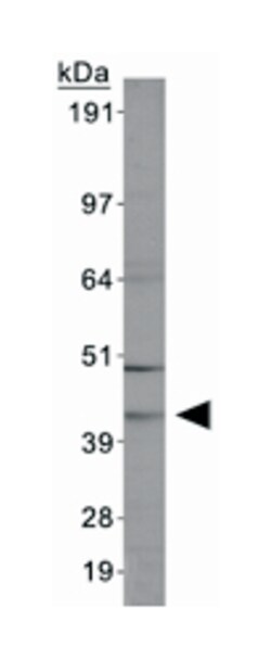 ABHD5 Rabbit anti-Human, Polyclonal Antibody, Abnova 100&mu;L; Unlabeled:Antibodies,