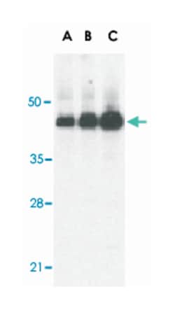 Casp12 Rabbit anti-Human, Mouse, Rat, Polyclonal Antibody, Abnova 100&mu;g;