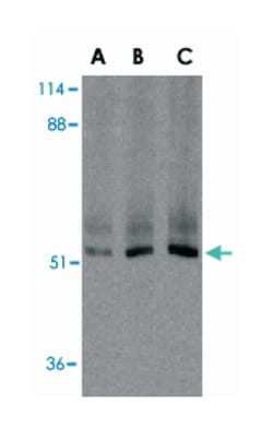 XIAP Rabbit anti-Human, Mouse, Polyclonal Antibody, Abnova 100&mu;g; Unlabeled:Antibodies,