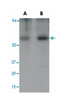CLU, Rabbit, Polyclonal Antibody, Abnova 100&mu;g; Unlabeled:Antibodies,