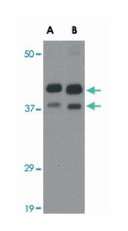 AIPL1 Rabbit anti-Human, Mouse, Rat, Polyclonal Antibody, Abnova 100&mu;g;