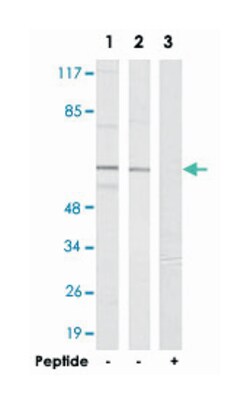 SLC43A1 Rabbit anti-Human, Polyclonal Antibody, Abnova 100&mu;g; Unlabeled:Antibodies,