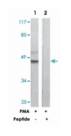C5AR1 Rabbit anti-Human, Polyclonal Antibody, Abnova 100&mu;g; Unlabeled:Antibodies,