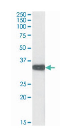 Aspa, Goat, Polyclonal Antibody, Abnova 100 &mu;g | Buy Online | Abnova Corporation | Fisher Scientific