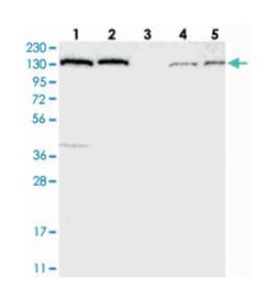 PFAS Rabbit anti-Human, Polyclonal Antibody, Abnova 100&mu;L; Unlabeled:Antibodies,