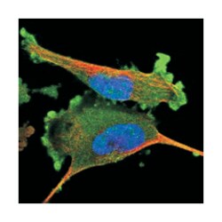 ADSS, Rabbit, Polyclonal Antibody, Abnova 100 &mu;L | Buy Online | Abnova Corporation | Fisher Scientific