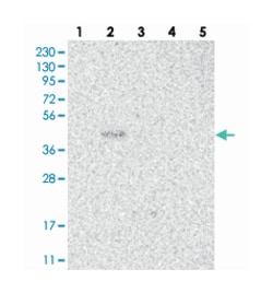 PNRC1, Rabbit, Polyclonal Antibody, Abnova 100 &mu;L | Buy Online | Abnova Corporation | Fisher Scientific