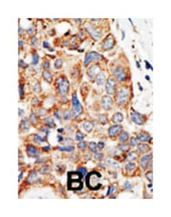 PIAS4 Rabbit anti-Human, Polyclonal Antibody, Abnova 400 &mu;L | Buy Online | Abnova | Fisher Scientific