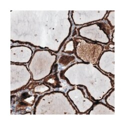 LRIT2, Rabbit, Polyclonal Antibody, Abnova 100 &mu;L | Buy Online | Abnova Corporation | Fisher Scientific