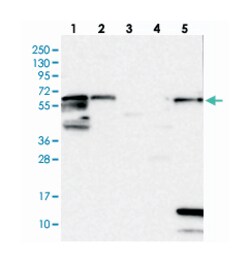 ME3 Rabbit anti-Human, Polyclonal Antibody, Abnova 100&mu;L; Unlabeled:Antibodies,