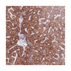 FBRS, Rabbit, Polyclonal Antibody, Abnova 100&mu;L; Unlabeled:Antibodies,