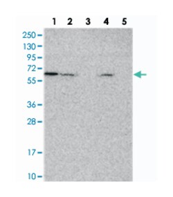KATNAL1, Rabbit, Polyclonal Antibody, Abnova 100 &mu;L | Buy Online | Abnova Corporation | Fisher Scientific