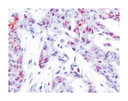 ATF4 Rabbit anti-Human, Polyclonal Antibody, Abnova 100 &mu;L | Buy Online | Abnova Corporation | Fisher Scientific