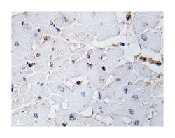 AKAP13, Rabbit, Polyclonal Antibody, Abnova 100&mu;L; Unlabeled:Antibodies,