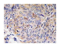 IL32 Rabbit anti-Human, Polyclonal Antibody, Abnova 100 &mu;L | Buy Online | Abnova Corporation | Fisher Scientific