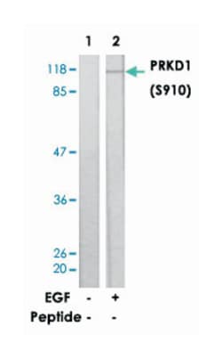 PRKD3 (phospho S910), Rabbit anti-Human, Mouse, Rat, Polyclonal Antibody,