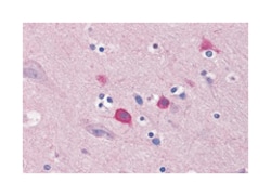 BOK, Rabbit, Polyclonal Antibody, Abnova 100&mu;g; Unlabeled:Antibodies,