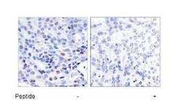 NFKB1 Rabbit anti-Human, Mouse, Rat, Polyclonal Antibody, Abnova 100 &mu;g | Buy Online | Abnova Corporation | Fisher Scientific