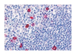 CNR2 Rabbit anti-Human, Polyclonal Antibody, Abnova 50 &mu;g | Buy Online | Abnova Corporation | Fisher Scientific