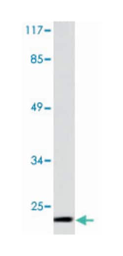 CLDN5 Rabbit anti-Human, Mouse, Rat, Polyclonal Antibody, Abnova 100 &mu;L | Buy Online | Abnova Corporation | Fisher Scientific