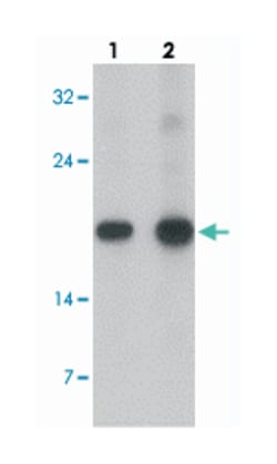 TNFSF4, Rabbit, Polyclonal Antibody, Abnova 100 &mu;g | Buy Online | Abnova Corporation | Fisher Scientific