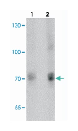 TRIM33, Rabbit, Polyclonal Antibody, Abnova 100 &mu;g | Buy Online | Abnova Corporation | Fisher Scientific